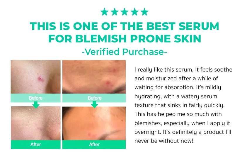 BRING GREEN - Zinc Teca Blemish Serum Set Squid Game Edition