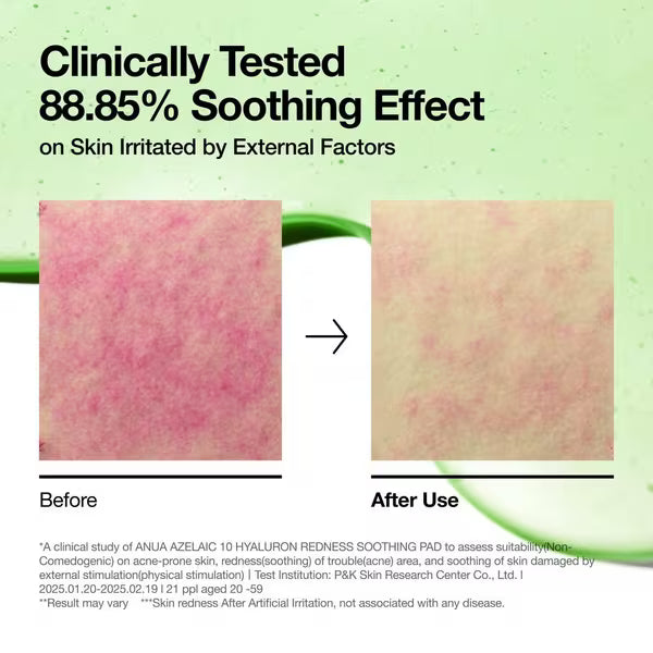 [ANUA] AZELAICACID 10 HYALURON REDNESS SOOTHING PAD 230ml (90EA)