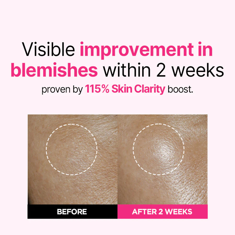 ISOI Blemish Care Up Serum 35ml