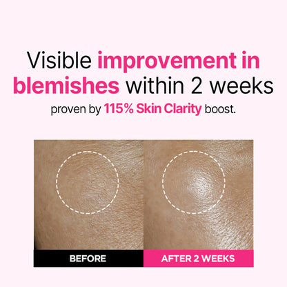 ISOI Blemish Care Up Serum 35ml