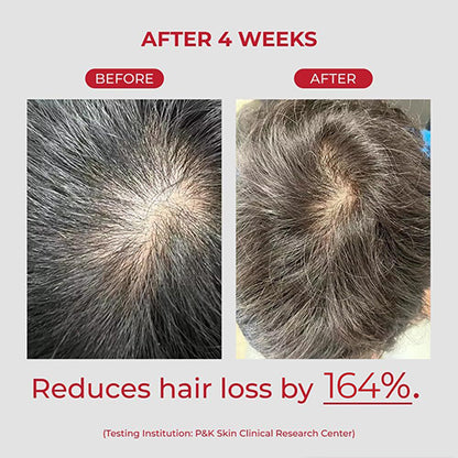 [MOEV] ANNURCATIN SHAMPOO 525ml