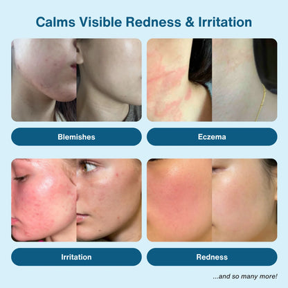 honeydew Labs hypochlorous spray ( The BIG bottle, 200ml)