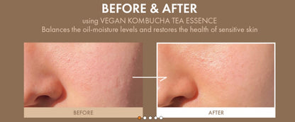 [Dr.Ceuracle] VEGAN KOMBUCHA TEA ESSENCE 150ml